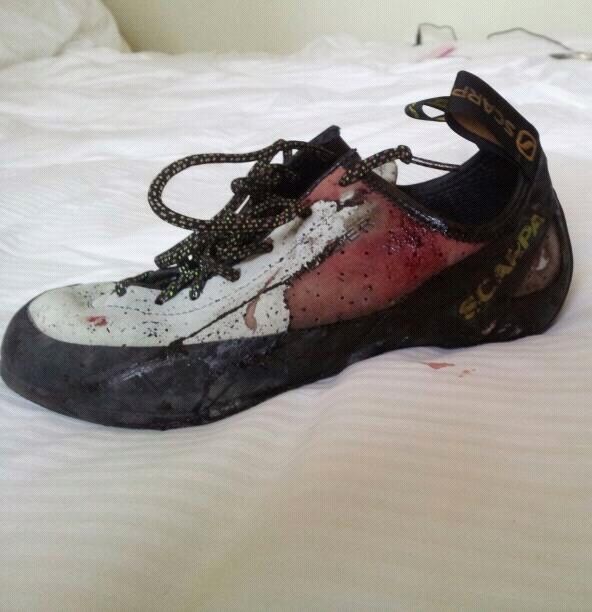 A bloody shoe.